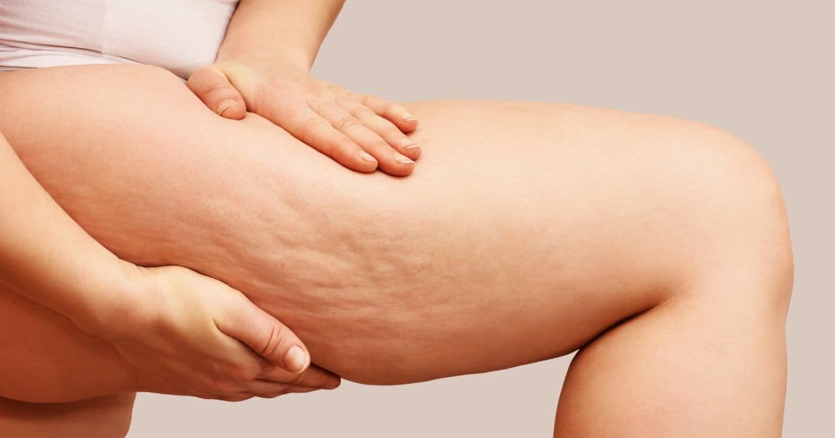 woman holding her thigh