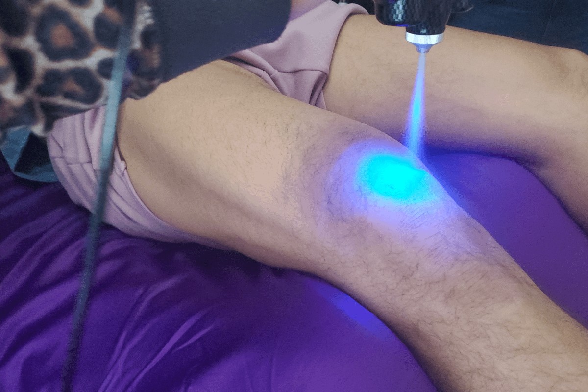cryotherapy to the knee