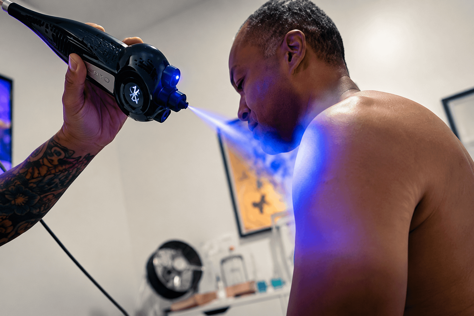 cryotherapy blast to left shoulder