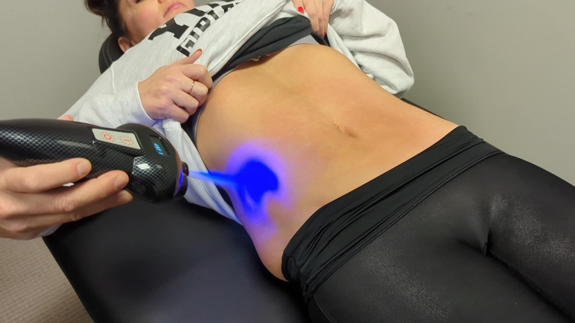 Lady laying on massage table getting cryotherpay to her stomach