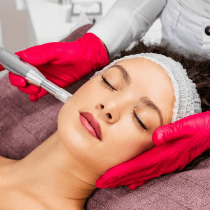 Microneedling to woman's face