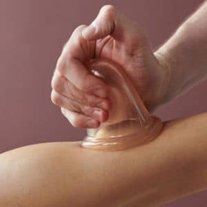 therapist cupping someone's back