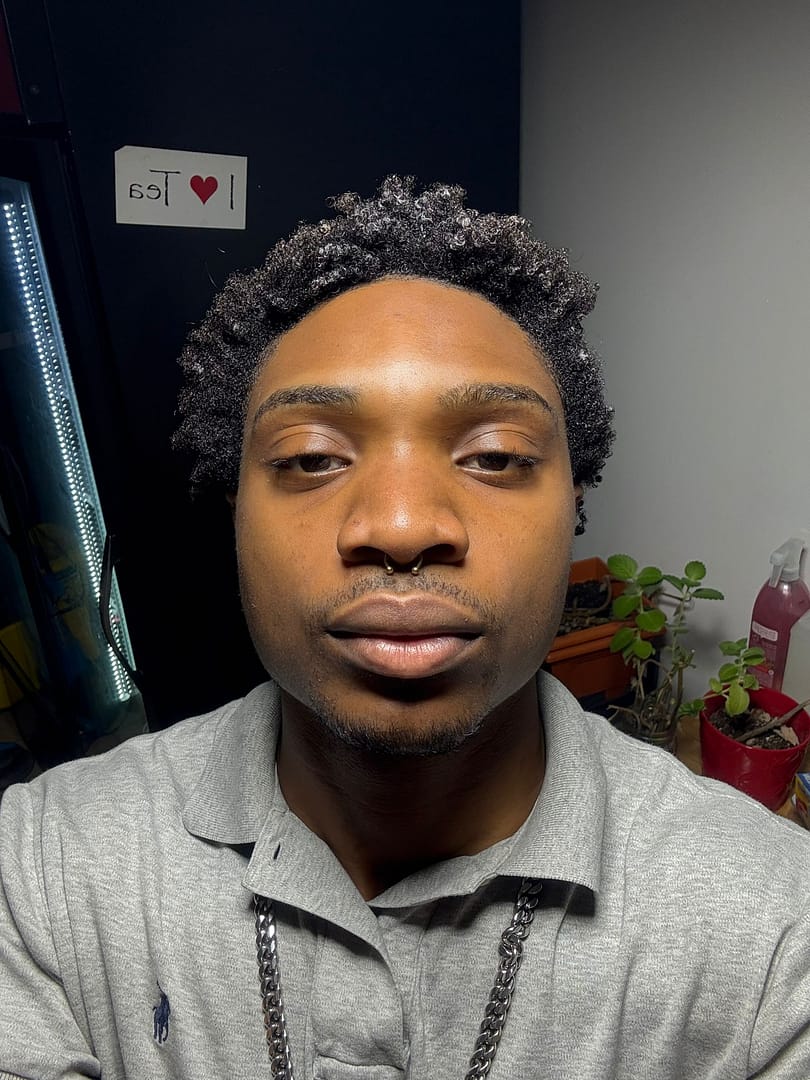 Man's face after VI Peel