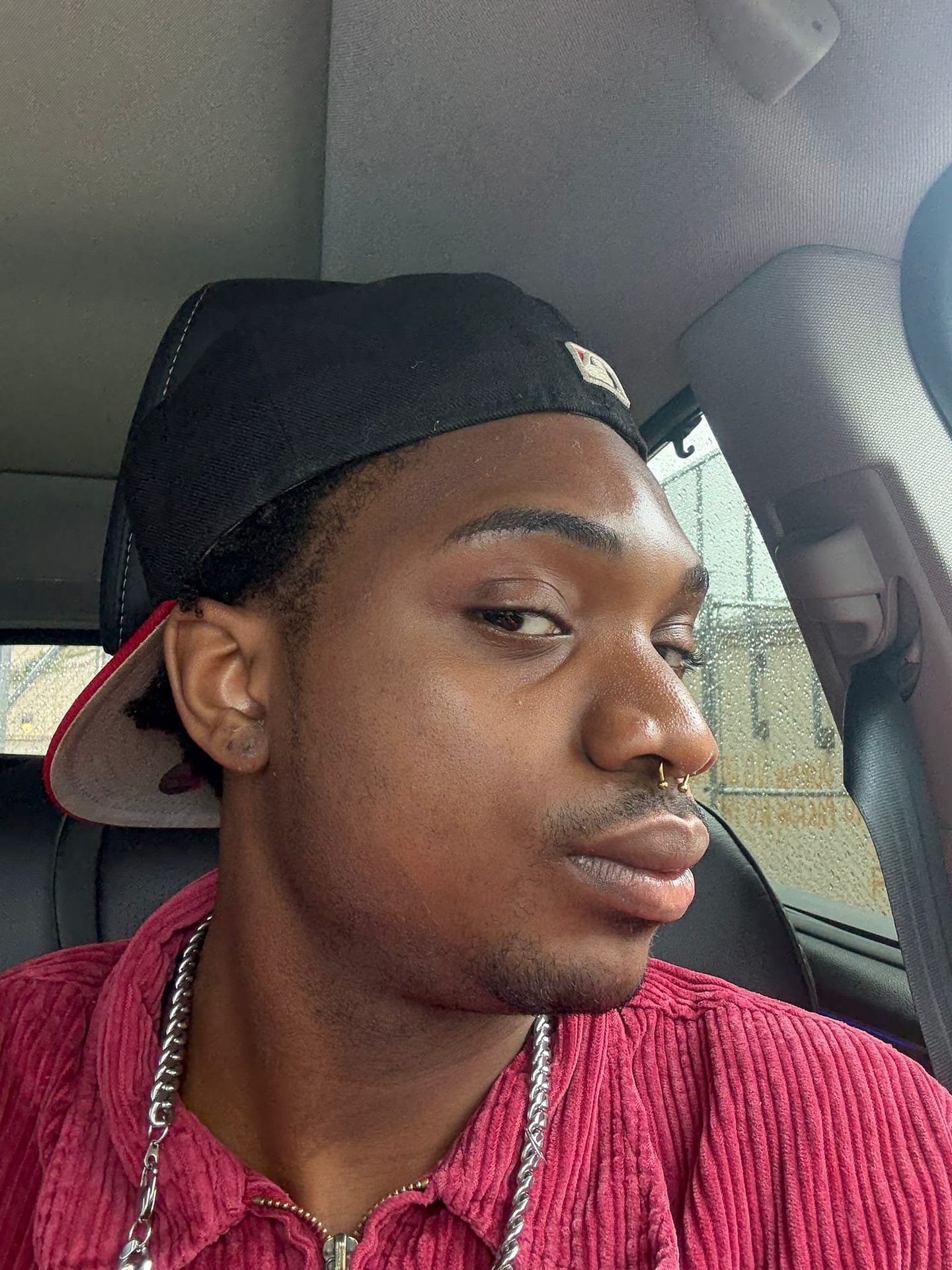 Man's face after VI Peel